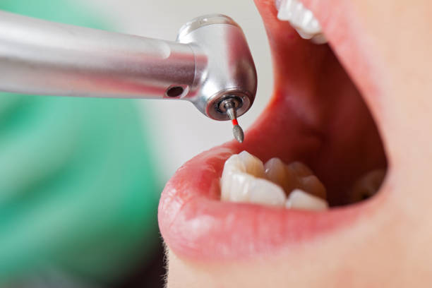 Best Tooth Infection Emergency Dentist  in Lafayette, GA